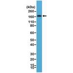 PDGFRB Antibody in Western Blot (WB)