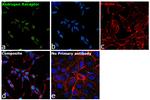 Androgen Receptor Antibody in Immunocytochemistry (ICC/IF)