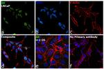 Androgen Receptor Antibody