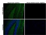 CD56 (NCAM) Antibody in Immunohistochemistry (Paraffin) (IHC (P))