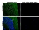 CD56 (NCAM) Antibody