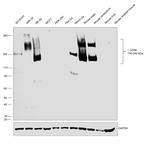 CD56 (NCAM) Antibody