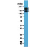 CD56 (NCAM) Antibody in Western Blot (WB)