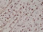 MYOD Antibody in Immunohistochemistry (Paraffin) (IHC (P))