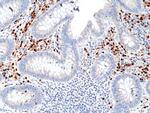 IRF4 Antibody in Immunohistochemistry (Paraffin) (IHC (P))