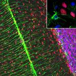 MECP2 Antibody in Immunohistochemistry (IHC)