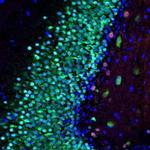 MECP2 Antibody in Immunohistochemistry (IHC)