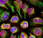 Nuclear Pore Complex Antibody in Immunocytochemistry (ICC/IF)