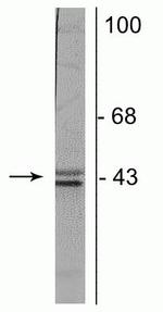 Doublecortin Antibody in Western Blot (WB)