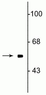 FTO Antibody in Western Blot (WB)