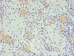 CD59 Antibody in Immunohistochemistry (Paraffin) (IHC (P))