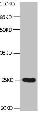 CD59 Antibody in Western Blot (WB)