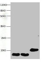 FABP3 Antibody in Western Blot (WB)