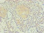 PLA2G7 Antibody in Immunohistochemistry (Paraffin) (IHC (P))