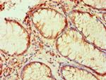 PLA2G7 Antibody in Immunohistochemistry (Paraffin) (IHC (P))