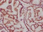 ATF2 Antibody in Immunohistochemistry (Paraffin) (IHC (P))