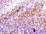 CD81 Antibody in Immunohistochemistry (Paraffin) (IHC (P))