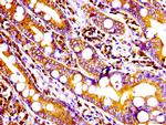 CD9 Antibody in Immunohistochemistry (Paraffin) (IHC (P))