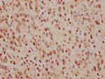 Cdc25C Antibody in Immunohistochemistry (Paraffin) (IHC (P))