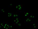 p27 Kip1 Antibody in Immunocytochemistry (ICC/IF)