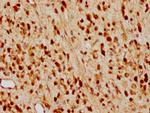 p27 Kip1 Antibody in Immunohistochemistry (Paraffin) (IHC (P))