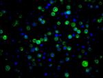 CD21 Antibody in Immunocytochemistry (ICC/IF)