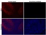 CD21 Antibody in Immunohistochemistry (Paraffin) (IHC (P))