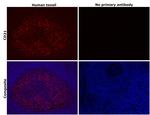 CD21 Antibody in Immunohistochemistry (Paraffin) (IHC (P))