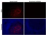 CD21 Antibody in Immunohistochemistry (Paraffin) (IHC (P))