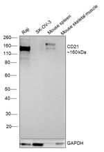 CD21 Antibody in Western Blot (WB)