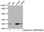 Phospho-eIF4E (Ser209) Antibody in Western Blot (WB)