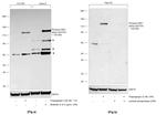 Phospho-IRE1 alpha (Ser724) Antibody in Western Blot (WB)