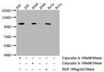 Phospho-IRE1 alpha (Ser724) Antibody in Western Blot (WB)