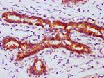 Phospho-FOXO3A (Ser253) Antibody in Immunohistochemistry (Paraffin) (IHC (P))