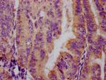 Phospho-FOXO3A (Ser253) Antibody in Immunohistochemistry (Paraffin) (IHC (P))