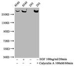 Phospho-mTOR (Ser2481) Antibody in Western Blot (WB)