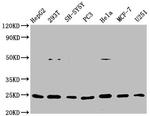 GDNF Antibody in Western Blot (WB)