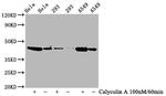 Phospho-GSK3B (Ser9) Antibody in Western Blot (WB)