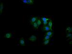 Phospho-GYS1 (Ser641) Antibody in Immunocytochemistry (ICC/IF)