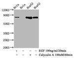 Phospho-GYS1 (Ser641) Antibody in Western Blot (WB)