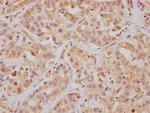 HDAC6 Antibody in Immunohistochemistry (Paraffin) (IHC (P))