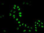 HDAC9 Antibody in Immunocytochemistry (ICC/IF)