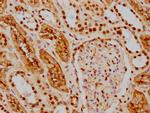 HDAC9 Antibody in Immunohistochemistry (Paraffin) (IHC (P))