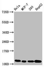 H4K5ac Antibody in Western Blot (WB)