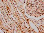 hnRNP C Antibody in Immunohistochemistry (Paraffin) (IHC (P))