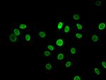 hnRNP K Antibody in Immunocytochemistry (ICC/IF)