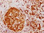 hnRNP K Antibody in Immunohistochemistry (Paraffin) (IHC (P))