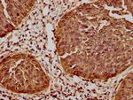 HSP27 Antibody in Immunohistochemistry (Paraffin) (IHC (P))