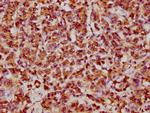 HSP27 Antibody in Immunohistochemistry (Paraffin) (IHC (P))