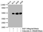 Phospho-c-Jun (Ser63) Antibody in Western Blot (WB)